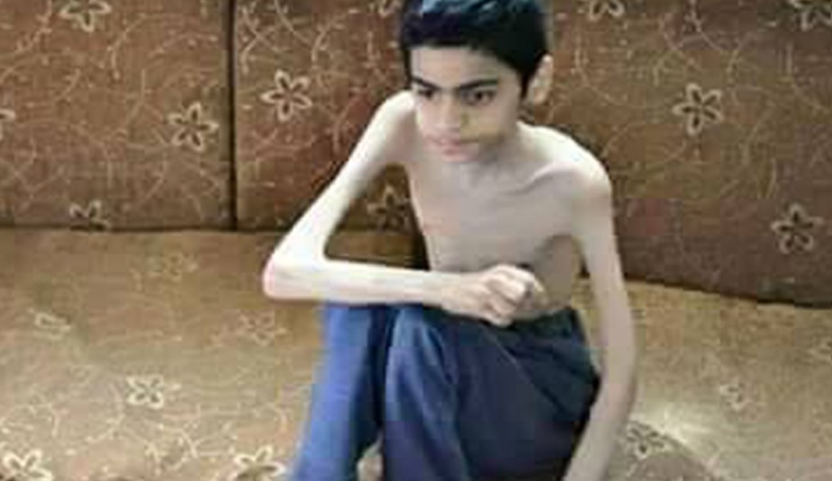   به‌ وێنه‌.. منداڵانی مه‌زایا له‌ برسان ده‌مرن